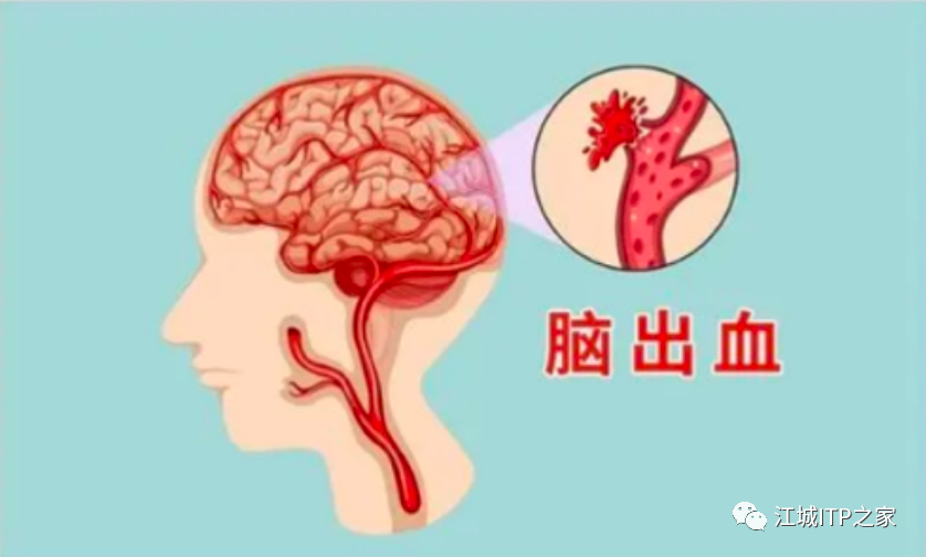 一问医答 | 原发免疫性血小板减少症(ITP)常见问题-ITP家园
