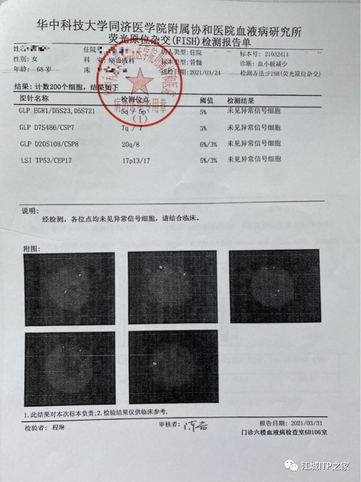 大咖谈病例 | 梅恒教授点评—肿瘤化疗后血小板减少症(CIT)病例解析-ITP家园
