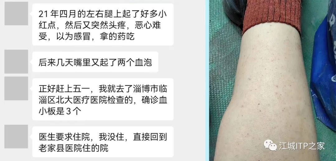 病友故事 | 幸运的是,煎熬中我迎来了新生-ITP家园